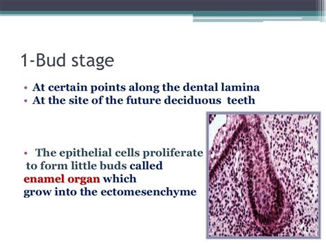 Stages of tooth development