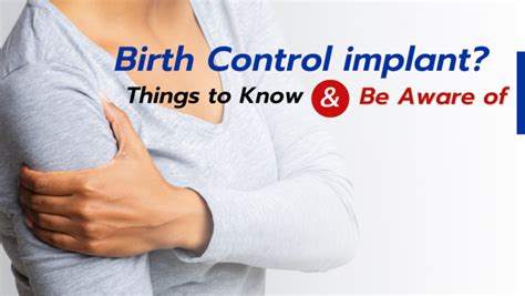 Birth Control implant? Things to Know & Be Aware of | Chiangmai Hospital | Tel : 053 225 222