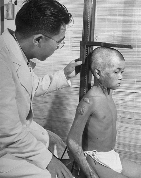 Hiroshima: Photos of Survivors of the World's First Atomic Attack ...