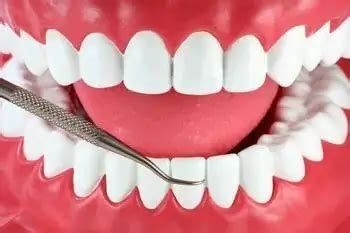Bleeding gums: causes, treatment | Dentistry 2024