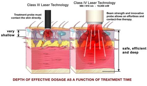 WHAT IS CLASS IV LASER THERAPY