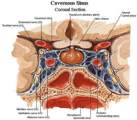 Pictures Of Cavernous Sinus