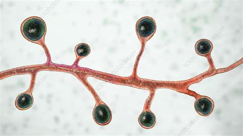 Blastomyces fungus, illustration - Stock Image - F036/0492 - Science Photo Library