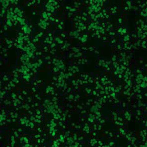 Green Fluorescent HT-29 Cell Line - Innoprot Stable Cell Lines