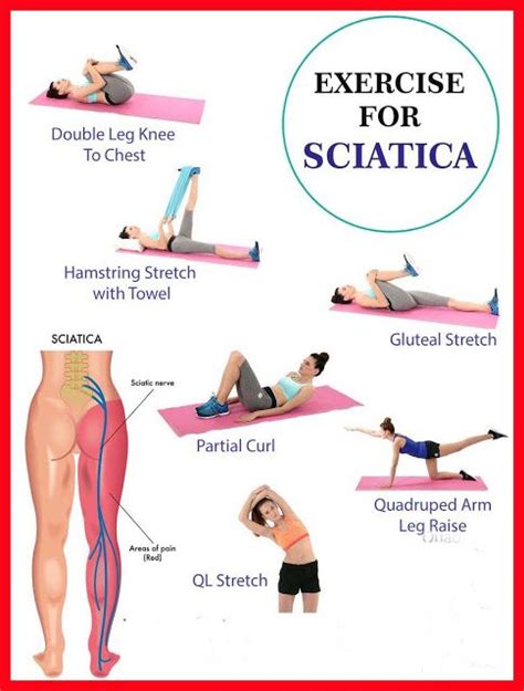 Pin on Sciatica cure and treatment