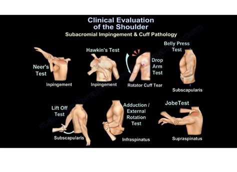 Shoulder Abduction Manual Muscle Test