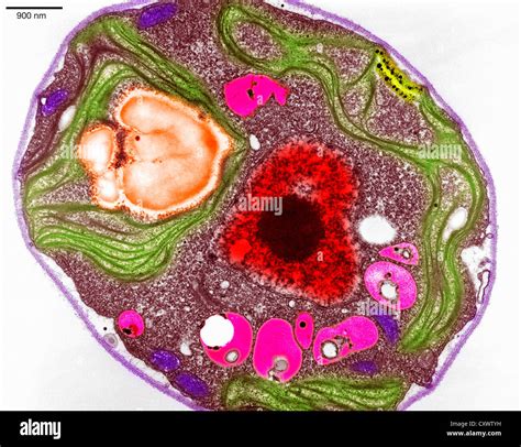 Plant Cells Under Electron Microscope Micropedia