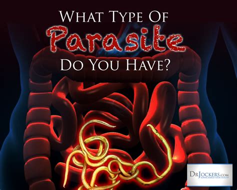 What Type of Parasites do You Have? - DrJockers.com Parasites Symptoms ...