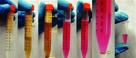 (a) After the initial centrifugation step for removal of red blood... | Download Scientific Diagram