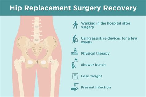 Hip Replacement Recovery: Tips from Doctors and Patients