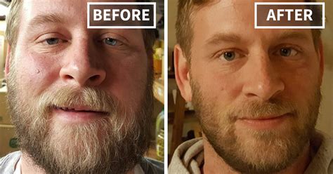 50 Before-And-After Pics Show What Happens When You Stop Drinking | Bored Panda