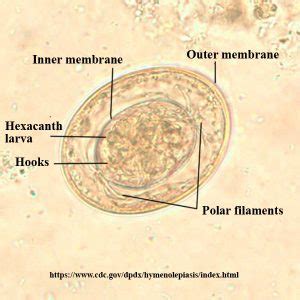 Hymenolepis nana – Egg – Parasitology