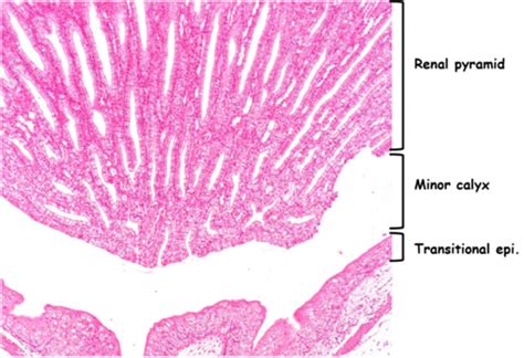 Minor Calyx Histology