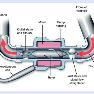 Components of the HeartMate ® II left ventricular assist device. Blood... | Download Scientific ...