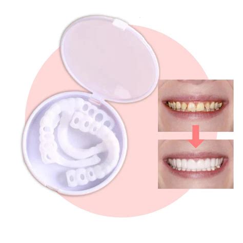 【LAST DAY SALE】Snap-on teeth™ - Always the perfect smile with these ve ...