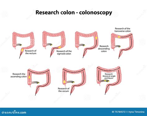 Colonoscopy Diagram Anatomy