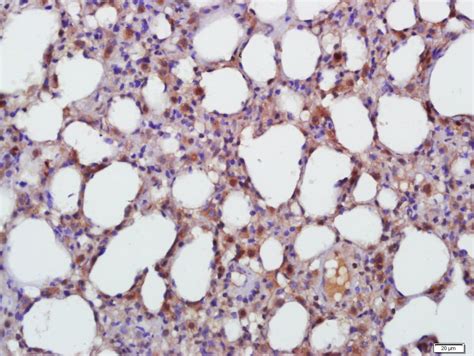 TGF beta 1 Antibody (BS-0086R)