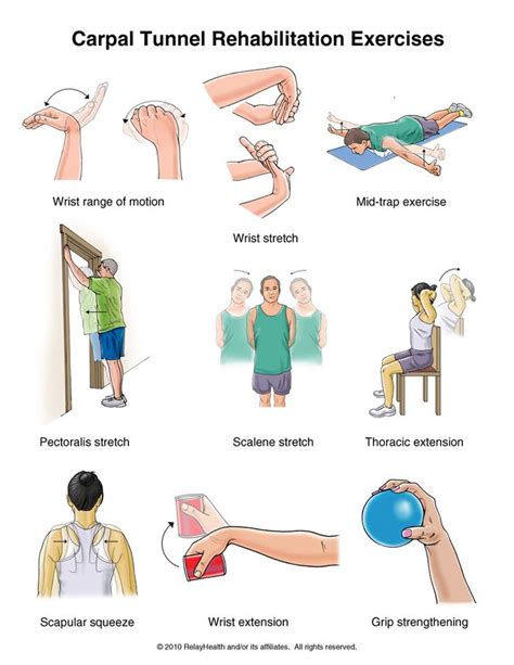 12 best Carpal Tunnel Syndrome images on Pinterest | Carpal tunnel ...