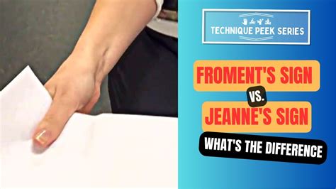 Froment's Sign vs Jeanne's Sign | Technique Peek Series - YouTube