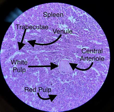 Spleen Histology.