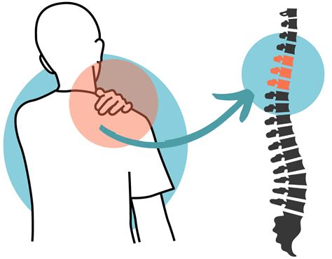 Shoulder pain: Causes & how to relieve it | Chiropractic Singapore