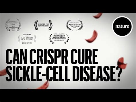 Can CRISPR cure Sickle-cell Disease? | Safe Videos for Kids