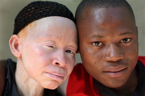 10 Heart-Wrenching Details Surrounding Djeneba Diarra, The Five-Year-Old Albino Child Who Was ...