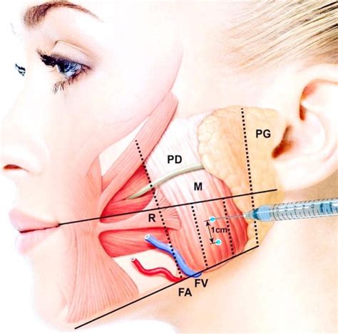 Bruxism - Simply Skin