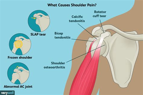 Anatomy of the Human Shoulder Joint