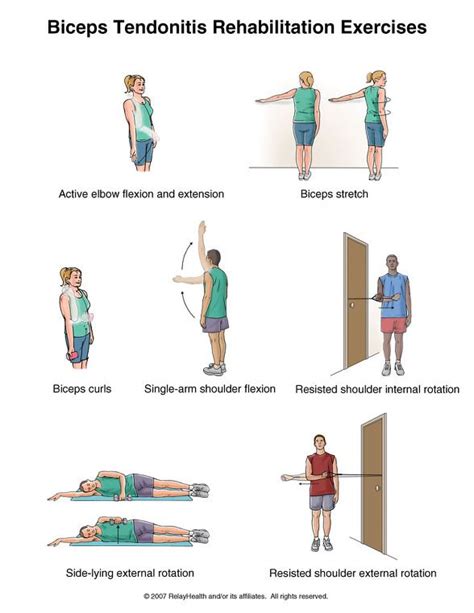 bicep tendinitis Bicep Tendonitis Exercises, Tendinitis, Elbow Tendonitis, Arm Exercises ...