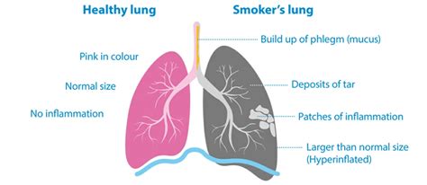 Why Is Smoking Harmful To Health? | VECEE Disposable Vapes