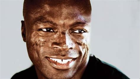 The Truth About The Scarring On Singer SEAL Face | BlackDoctor