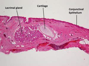 Follicular Conjunctivitis Histology