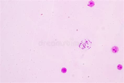 Chromosomes Human Under the Microscope. Stock Photo - Image of ...