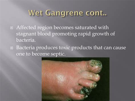 PPT - GaNGRENE PowerPoint Presentation, free download - ID:2349295