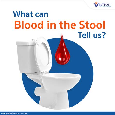 Best Blood On Stool Hemorrhoid of the decade Learn more here | stoolz