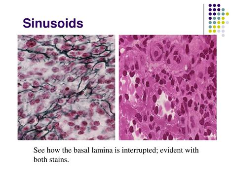 PPT - Thymus & Spleen PowerPoint Presentation, free download - ID:248247