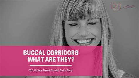 Buccal Corridors – What are they? | 128 Harley Street Dental