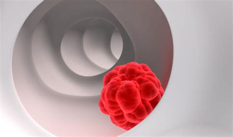 Wnt Pathway Inhibitor Fights Colorectal Cancer Stem Cells - Asian Scientist Magazine