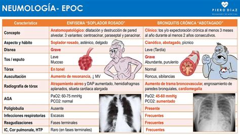 BRONQUITIS VS ENFISEMA (EPOC) - pierodiaz med | EPOC | Bronquitis | uDocz