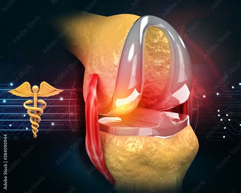 Human knee joint replace anatomy on medical background. 3d illustration ...