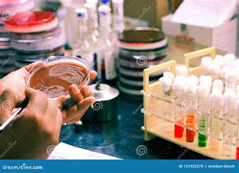 Bacterial Inoculation On A Test Tube Agar Culture Media Using ...