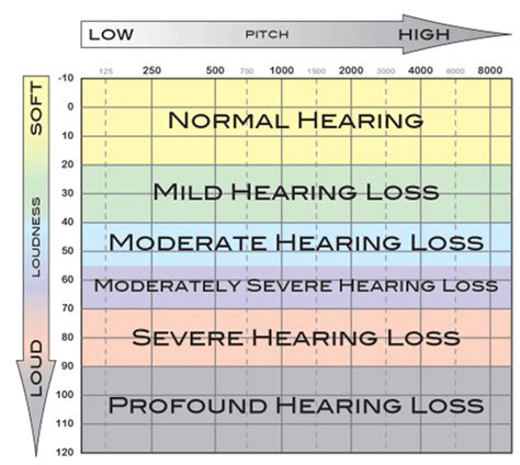 What "Degree of Hearing Loss" Means - Hearing Doctors of NJ