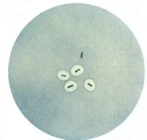 Quellung reaction: Principle, Procedure, Results • Microbe Online