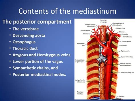 Mediastinal syndrome