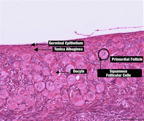 ovary-slide-labelled-histology | SchoolWorkHelper