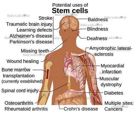 Ruby-Cell Global: Benefits of stem cells!!!