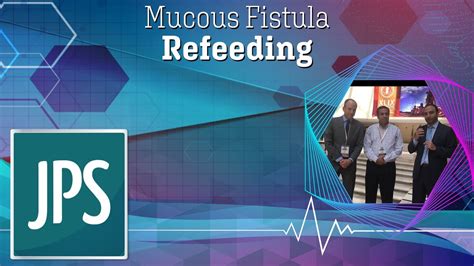 Mucous Fistula Refeeding - YouTube