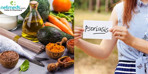 Psoriasis: Foods to Add And Avoid. Best Dietary Practices To Manage ...