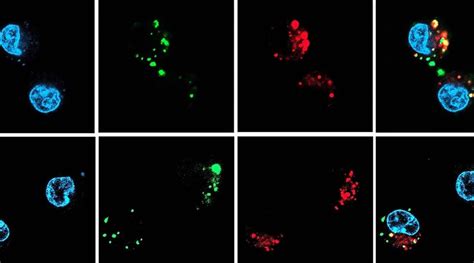 siRNA therapies delivered with oral nanocapsules - Advanced Science News